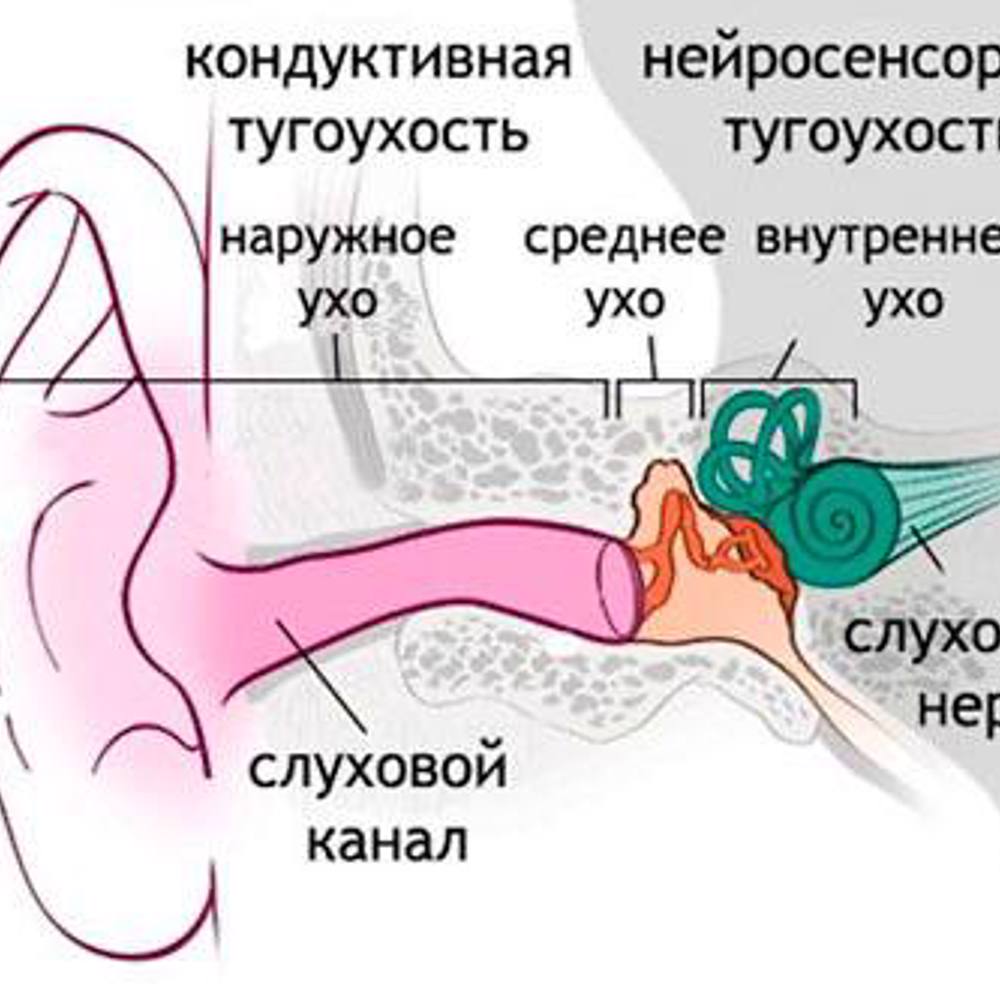 Почему при задержке речи важно проверить слух?